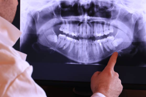 Best Emergency Treatment for Jaw Pain or Injury in Lynchburg, TN